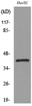 IL8R beta antibody