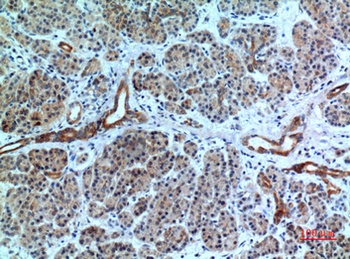 Bonzo antibody