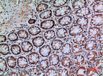 CD148 rabbit pAb Antibody