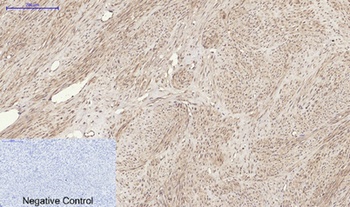 RANKL antibody