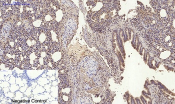 RANKL antibody