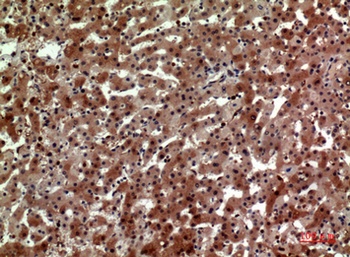 CD163b antibody