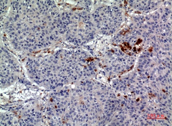 CD163b antibody