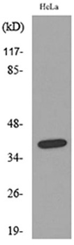 CD158b2/j rabbit pAb