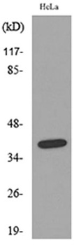 CD158b2/j antibody