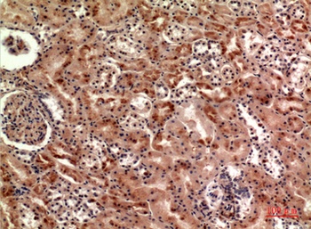 Cerberus antibody