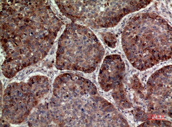 MDA-7 antibody