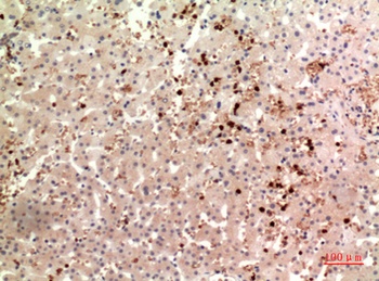 TPO antibody