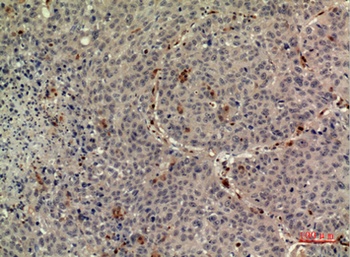 TPO antibody