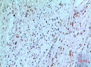 PD-ECGF rabbit pAb
