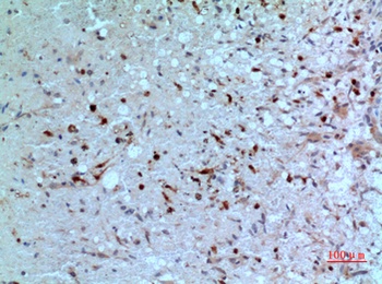 PD-ECGF antibody