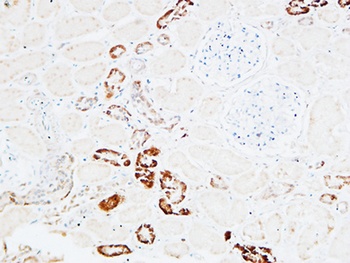PD-ECGF rabbit pAb
