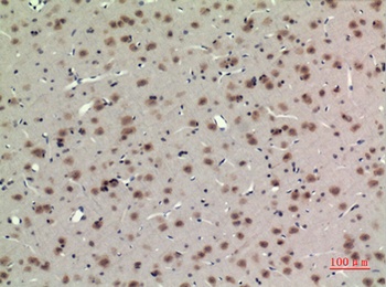 BMAL1 antibody