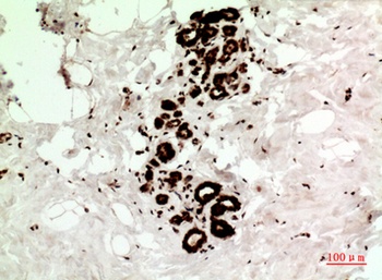 HSP70 rabbit pAb Antibody
