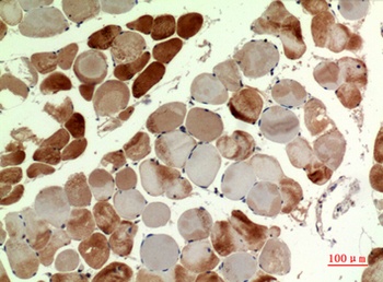 MYH-pan antibody