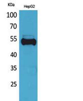 Ub rabbit pAb Antibody