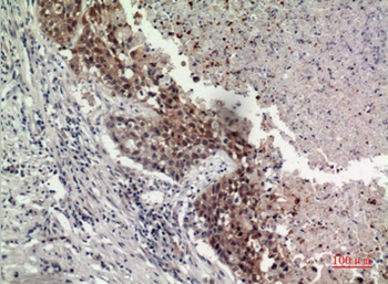 GPR87/95 antibody