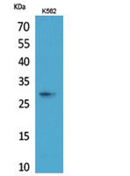 ApoA-I antibody