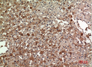 ApoA-I antibody