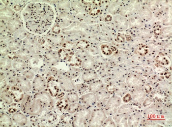 MAPK Organizer 1 antibody