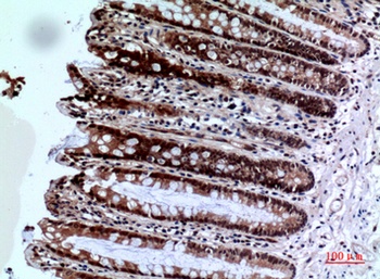 FOXP3 antibody