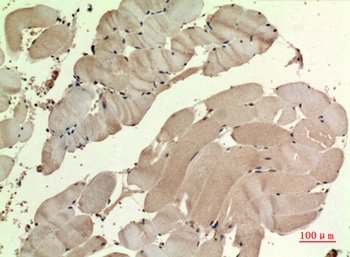 SDHB antibody