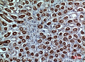 Neuropilin antibody