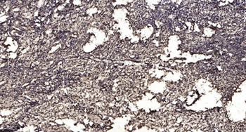 SNRPN antibody