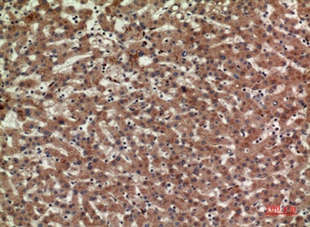 CD3 delta antibody