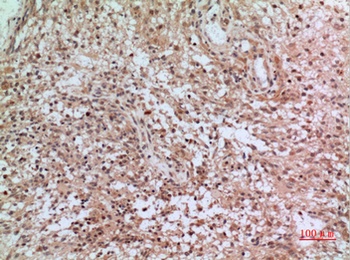 CD3 delta antibody