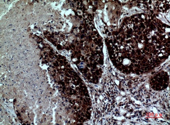 Integrin alpha D antibody