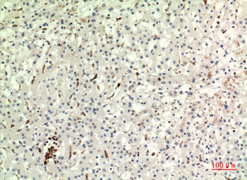 CD74 antibody