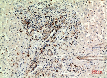 CD74 antibody