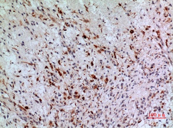 CD74 antibody