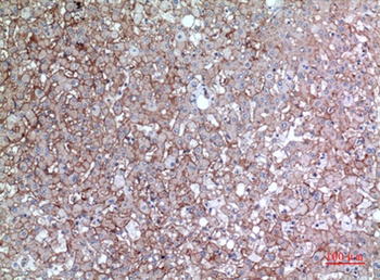 EMMPRIN antibody