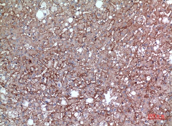 EMMPRIN antibody