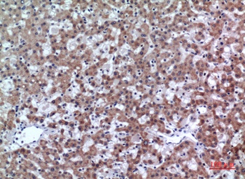 CD200 antibody