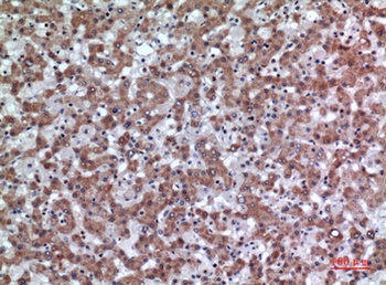 CD200 antibody