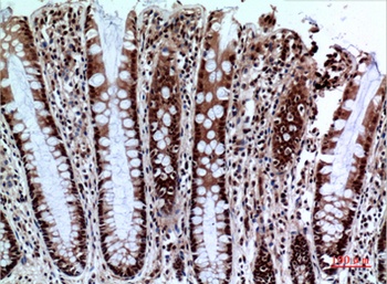 NKp44 antibody