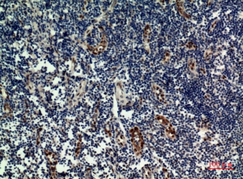 IL33 antibody