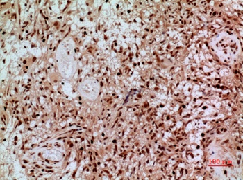 SAMHD1 antibody