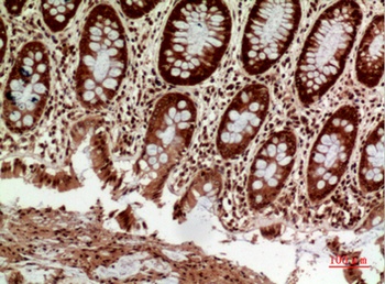 HLA-DQB1/2 antibody