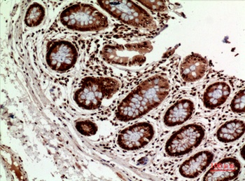 HLA-DQB1/2 antibody