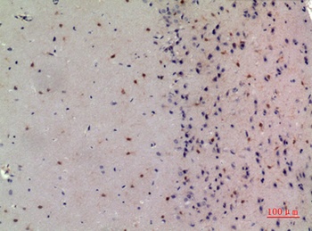 NCoA-3 rabbit pAb