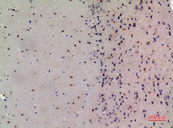 NCoA-3 antibody