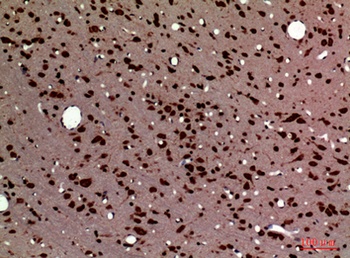 PTN antibody