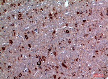 TRPC3 rabbit pAb