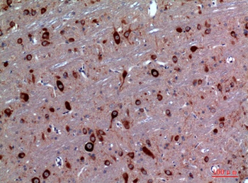 TRPC3 antibody