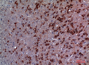 TRPC3 rabbit pAb