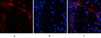 Ub antibody